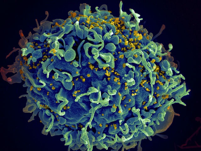 ابداغ روش «شوک و کشتن» برای درمان کامل HIV