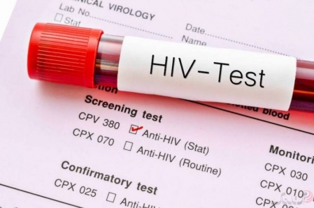 راهکار جدید دانشمندان برای کمک به مبتلایان HIV